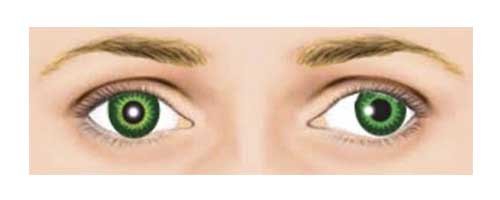 Headache above left eye